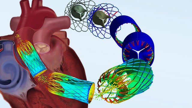 Simulation d’une valve aortique transcathétérale avec ANSYS Mechanical-CFD